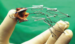 心脏支架手术视频,技术革新与患者康复之路